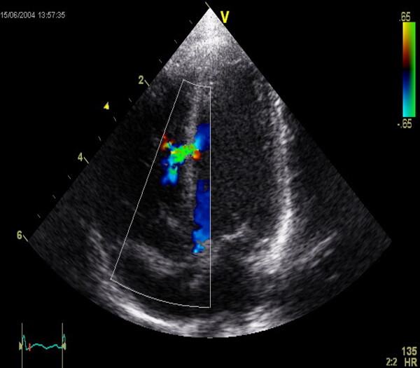 echocardiographers